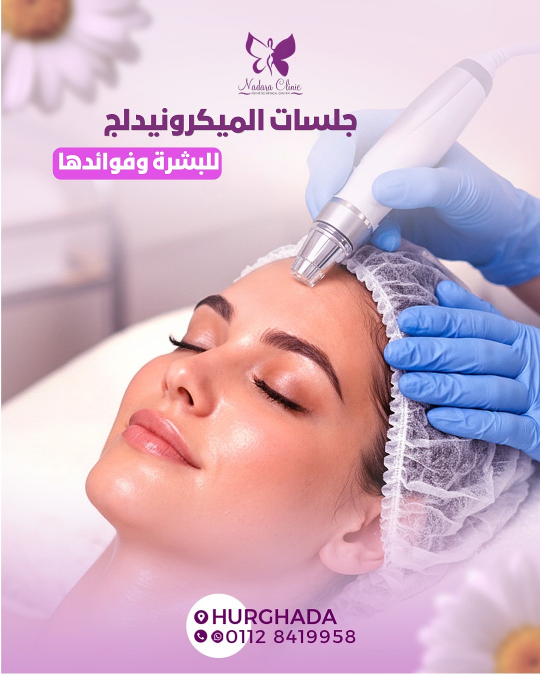 جلسات الميكرونيدلج للبشرة وفوائدها في الغردقة